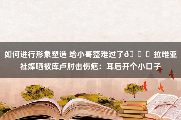 如何进行形象塑造 给小哥整难过了😅拉维亚社媒晒被库卢肘击伤疤：耳后开个小口子